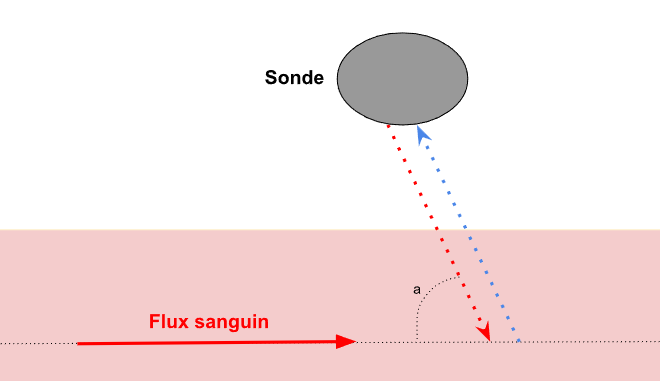 Schéma échographie Doppler